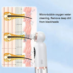 Super Micro Bubble Beauty Instrument - Image 3 | BNH Traders